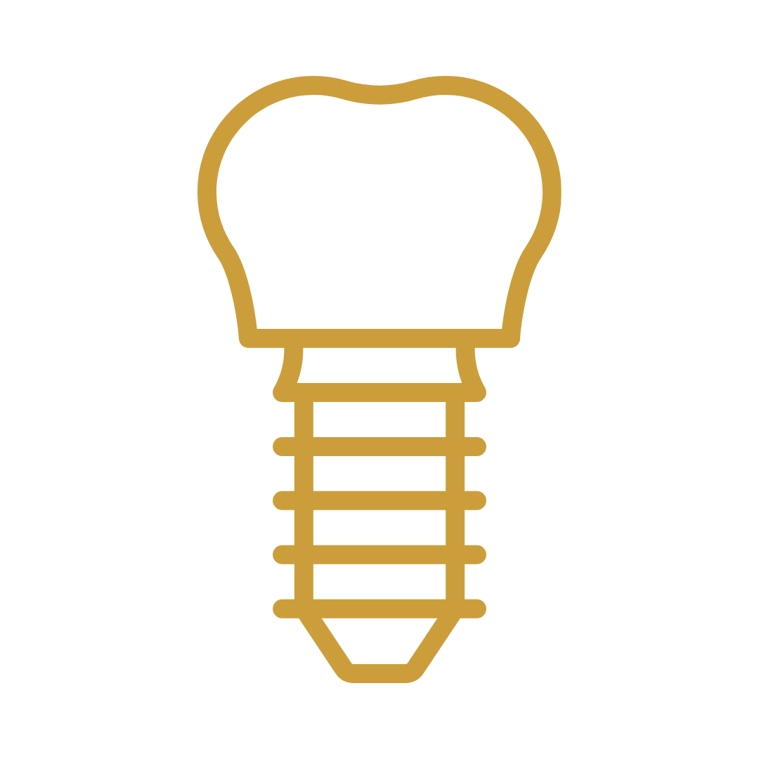 Implantes Dentários